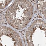 UBTD2 Antibody in Immunohistochemistry (Paraffin) (IHC (P))