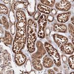 DCTD Antibody in Immunohistochemistry (Paraffin) (IHC (P))