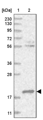 DCTD Antibody in Western Blot (WB)