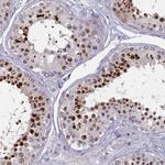 FAM196A Polyclonal Antibody