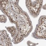 MED28 Polyclonal Antibody