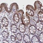 FAM206A Antibody in Immunohistochemistry (IHC)