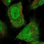 FAM206A Polyclonal Antibody