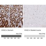 VSIG2 Antibody