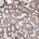 PEPP2 Polyclonal Antibody