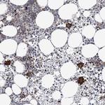 ARAP2 Antibody in Immunohistochemistry (Paraffin) (IHC (P))
