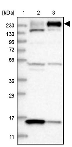 ARAP2 Antibody in Western Blot (WB)