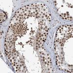 PLRG1 Antibody in Immunohistochemistry (Paraffin) (IHC (P))