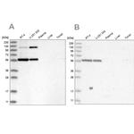 PLRG1 Antibody in Western Blot (WB)