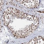 PLRG1 Polyclonal Antibody