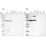 PLRG1 Antibody in Western Blot (WB)