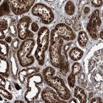 NDUFA2 Antibody in Immunohistochemistry (Paraffin) (IHC (P))