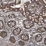 NDUFA2 Antibody in Immunohistochemistry (Paraffin) (IHC (P))