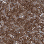 NDUFA2 Antibody in Immunohistochemistry (Paraffin) (IHC (P))