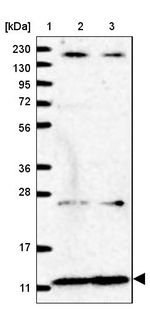 NDUFA2 Antibody in Western Blot (WB)