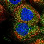 ZSWIM6 Polyclonal Antibody