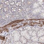 ZSWIM6 Antibody in Immunohistochemistry (Paraffin) (IHC (P))