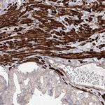 ZSWIM6 Antibody in Immunohistochemistry (Paraffin) (IHC (P))
