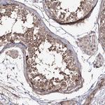 ZSWIM6 Antibody in Immunohistochemistry (Paraffin) (IHC (P))