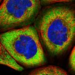 HARS2 Polyclonal Antibody