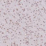 RBM27 Antibody in Immunohistochemistry (Paraffin) (IHC (P))