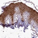 RBM27 Antibody in Immunohistochemistry (Paraffin) (IHC (P))