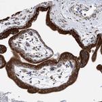 MED31 Antibody in Immunohistochemistry (Paraffin) (IHC (P))