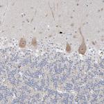 SDAD1 Antibody in Immunohistochemistry (Paraffin) (IHC (P))