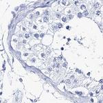 CSN3 (CASK) Antibody in Immunohistochemistry (IHC)