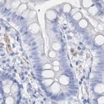 CSN3 (CASK) Antibody in Immunohistochemistry (IHC)