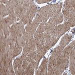 ZSCAN23 Polyclonal Antibody