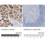 SLC22A13 Antibody in Immunohistochemistry (IHC)
