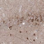 PCDHA1 Antibody in Immunohistochemistry (Paraffin) (IHC (P))