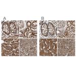 MUT Polyclonal Antibody