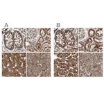 MUT Polyclonal Antibody