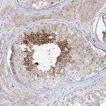 ADAMTS12 Polyclonal Antibody