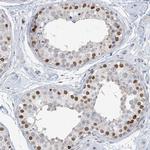 KMT2D Antibody in Immunohistochemistry (IHC)