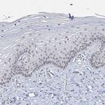 KMT2D Antibody in Immunohistochemistry (IHC)