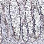 KMT2D Antibody in Immunohistochemistry (IHC)