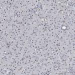 KMT2D Antibody in Immunohistochemistry (IHC)