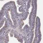 KAAG1 Antibody in Immunohistochemistry (Paraffin) (IHC (P))