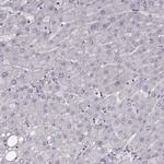 KAAG1 Antibody in Immunohistochemistry (Paraffin) (IHC (P))