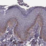 KAAG1 Polyclonal Antibody