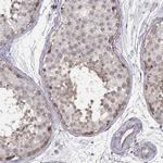 KAAG1 Antibody in Immunohistochemistry (IHC)