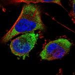 BDH2 Polyclonal Antibody