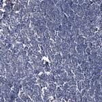BDH2 Antibody in Immunohistochemistry (Paraffin) (IHC (P))