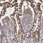 BDH2 Antibody in Immunohistochemistry (Paraffin) (IHC (P))
