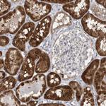 BDH2 Antibody in Immunohistochemistry (IHC)