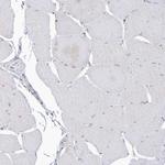 BDH2 Antibody in Immunohistochemistry (IHC)