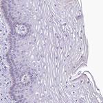 LMOD3 Antibody in Immunohistochemistry (Paraffin) (IHC (P))